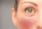 Cele mai frecvente afecțiuni dermatologice