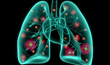 SĂNĂTATE: Pneumonia bacteriană: factori de risc, simptome, diagnostic şi tratament