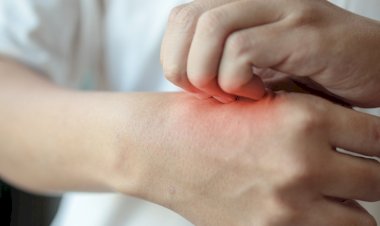 Mâini uscate și crăpate - soluții și remedii