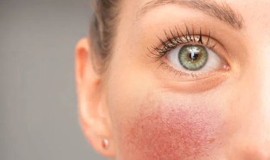 Cele mai frecvente afecțiuni dermatologice