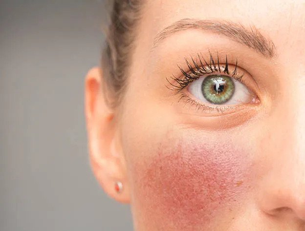 Cele mai frecvente afecțiuni dermatologice